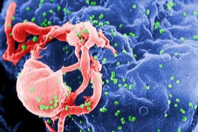 HIV speeds up body’s ageing process soon after infection, study finds