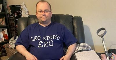 Lanarkshire dad's leg amputated after he trips on pyjamas and falls down stairs