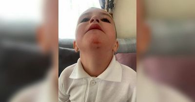 Dad's warning after son, 3, falls in 'insecure' manhole