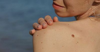 The 'silent changes' that could be a sign of skin cancer