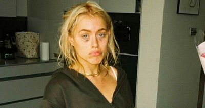 TikTok star Elle Brooke shows off bruises and calls out Love Islander for fight