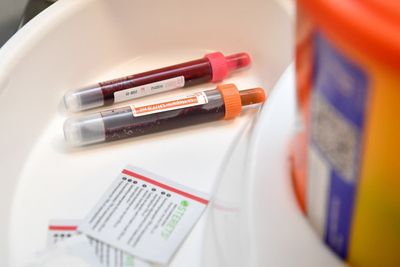 Blood test could predict future risk of leukaemia, study suggests