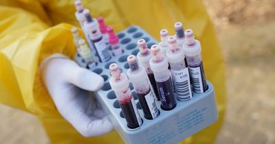 Blood donations at 'vulnerable' levels in Bristol due to rise in Covid cases