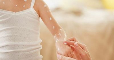 Mum fumes over teacher's 'ridiculous' comment after daughter caught chickenpox