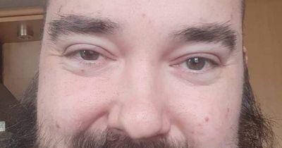 Edinburgh dad opens up on using food banks after pal went three days without eating