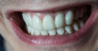 'Turkey teeth' warning after UK dental clinic is 'inundated' with botched veneers