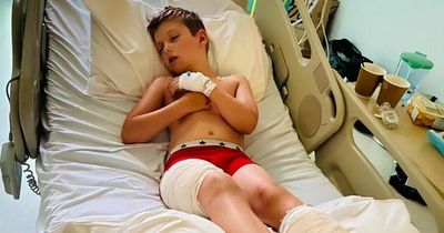 Schoolboy who suffered horrendous burns left permanently disfigured by 'red hot' sand from disposable BBQ