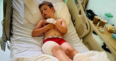 Call for barbecue ban after boy left permanently scarred by one used on beach