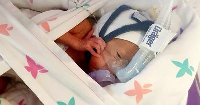 Baby kept alive in a plastic bag after being born 101 days early defies odds to go home