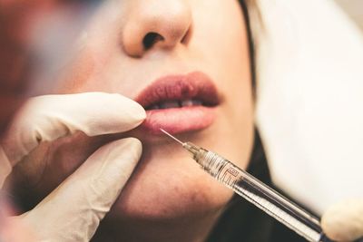 Cosmetic fillers could be restricted in Scotland for 'public safety'