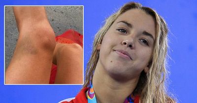 Swimmer claims she was drugged at World Championships after waking up with concussion