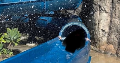 Mum shares distressing scans of daughter's face after waterslide accident