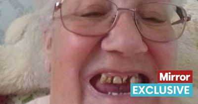 Woman's front teeth disintegrate while waiting for treatment as dentists quit NHS