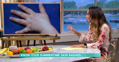 This Morning's Dr Sara Kayat warns of 'highly contagious' summer infection