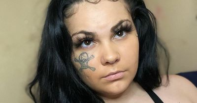 Woman gets huge £50 skull tattoo lasered off her head after bad break-up