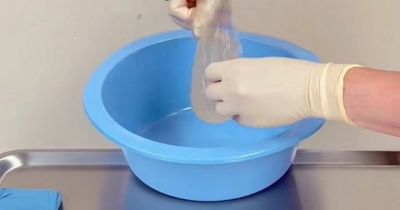 Doctor reveals what's inside 30-year-old breast implant - leaving people 'disturbed'