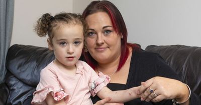 Girl, 3, almost dies after being attacked by CAT while walking in park