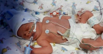"Without them she definitely wouldn't be here today": Mum thanks paramedics for life saving intervention for baby born two months early