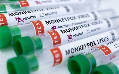 Suspected case of monkeypox reported in Kerala