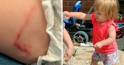 Toddler suffers burn after sitting on toy left in hot sun