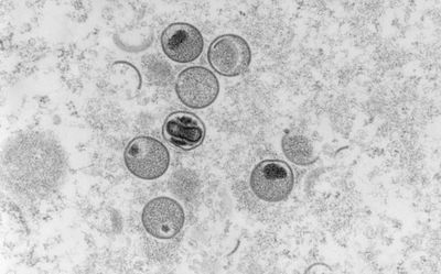 Ensure testing for monkeypox, Health Ministry tells States