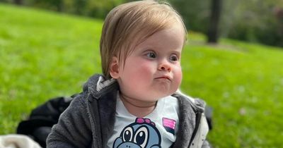 Adorable Edinburgh baby was first to have Spina Bifida operated on before birth