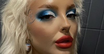 'Trolls said my forehead made me look like an alien, now I feel like a princess'