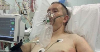 Man's lung collapses after stingray attack - says it'll make 'good pub story'