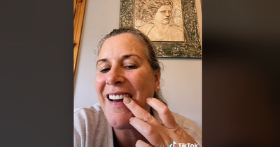 Irish woman warns others against dental trips abroad after coming home in pain and facing huge bills to fix teeth