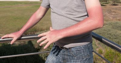 UK heatwave: Experts issue warning over sunburn myths as temperatures soar