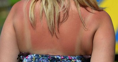Warning about sitting in the sun even in the window this weekend