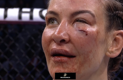 Twitter reacts to Miesha Tate’s bloody loss to Lauren Murphy at UFC on ABC 3