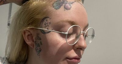 Woman bullied so badly over 'fivehead' she moved school has hairline moved