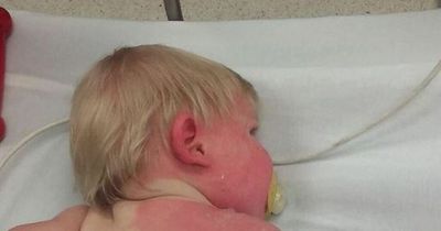 Child sprayed with water from a hose sat in the sun left seriously injured