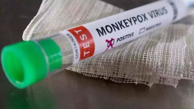 Second monkeypox case reported in Kerala