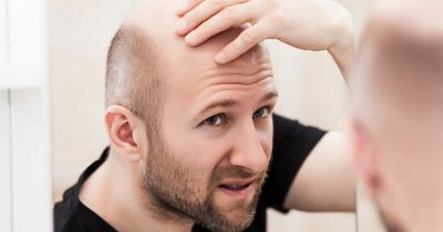 Commonly used grooming products can increase risk of balding, claims expert