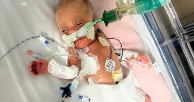 Mum and baby stranded in Cyprus facing £100k medical bill after premature birth