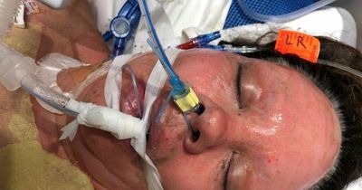 Mum's home blows up with her inside after Covid meant she didn't smell gas leak