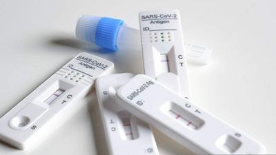 Random testing will determine Covid-19 prevalence