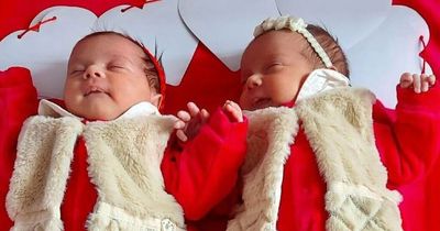 Incredible moment twins are born inside their amniotic sacs in one-in-80,000 event
