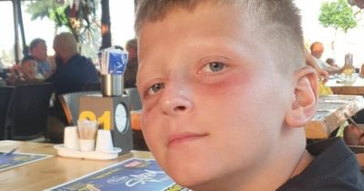 Schoolboy's holiday ruined after arms erupt in blisters despite using sun cream