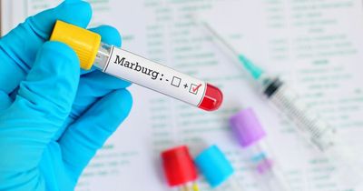 What is the Marburg virus and is it spreading as 2 patients die from Ebola-like disease