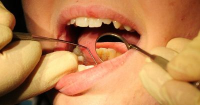 NHS rule change as dental check-ups now every two years