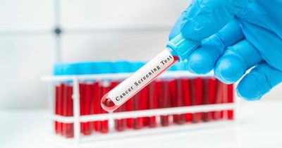 'Holy grail' blood test could diagnose any cancer years before symptoms