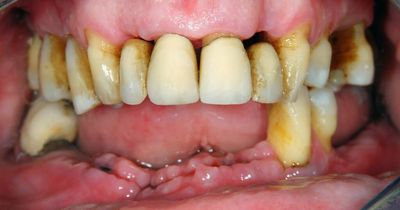 Heart disease to cancer – how your mouth could hold key clues to your health