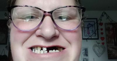 Desperate mum-of-two removes 13 of her own teeth after being unable to find NHS dentist