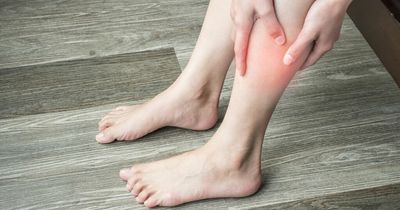 4 blood clot symptoms you should never ignore - colour changes to cramping