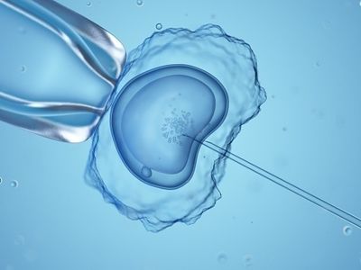 Infertility patients fear abortion bans could affect access to IVF treatment