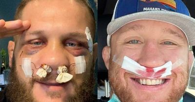 Justin Gaethje called out for 'nose job' fight against fellow UFC star