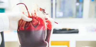 Long COVID: with no treatment options, it's little wonder people are seeking unproven therapies like 'blood washing'